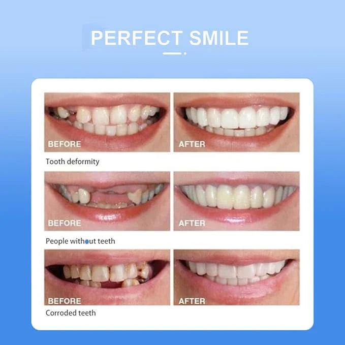 Snap-On Smile | ابتسامة مثالية في ثوانٍ